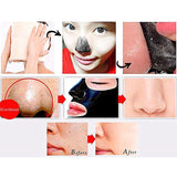 Deep Cleaning Acne Effective Comedo Remover Black Mask