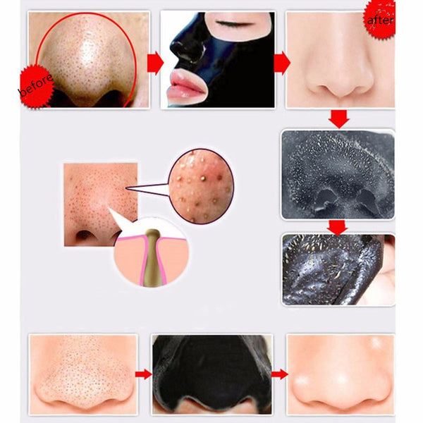 Deep Cleaning Acne Effective Comedo Remover Black Mask