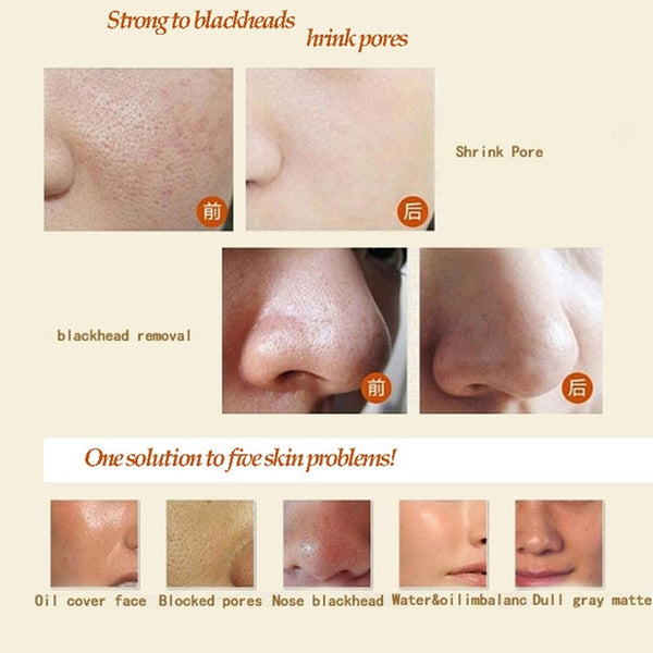 Thailand Aloe Acne Mask