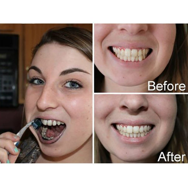 2pcs Activated Carbon Whitening Dentifrice - ilovealma