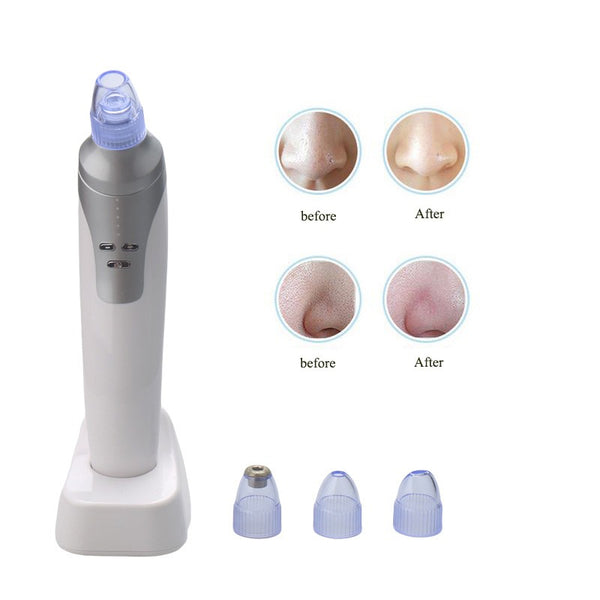Electronic Facial Pore Cleaner Nose Blackhead Cleansing Acne Remover