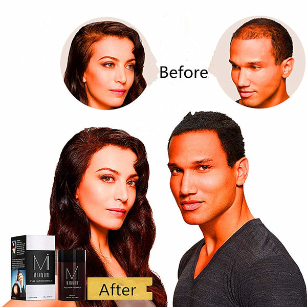 25G Protect Hair Growth Of Hair - ilovealma