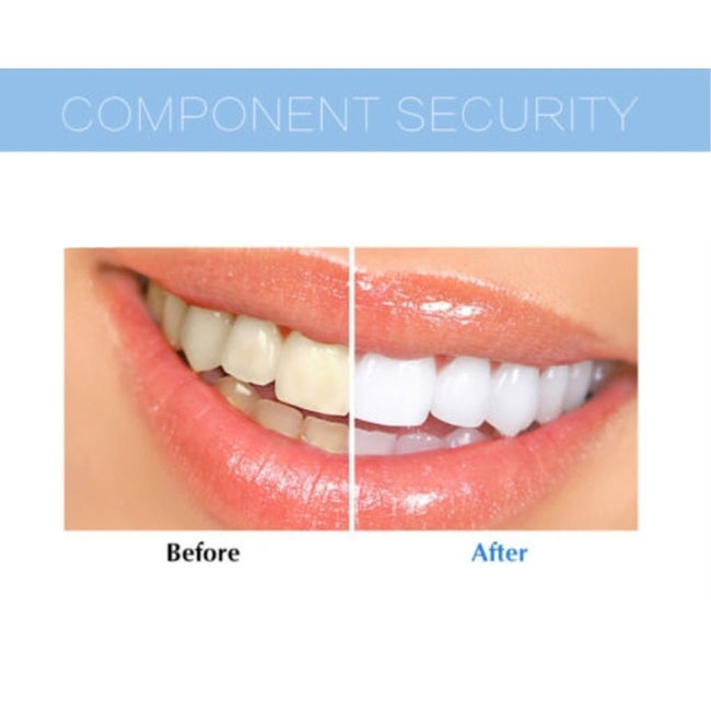 Extreme Teeth Whitening System: Bleaching LED + Oral Gel