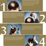 25G Protect Hair Growth Of Hair - ilovealma